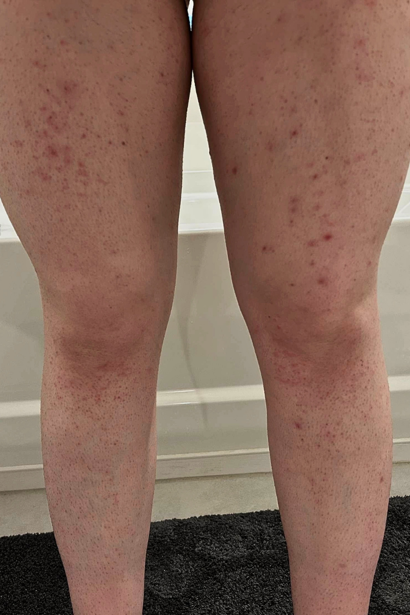 Legs