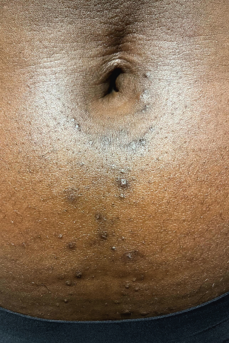 Stomach