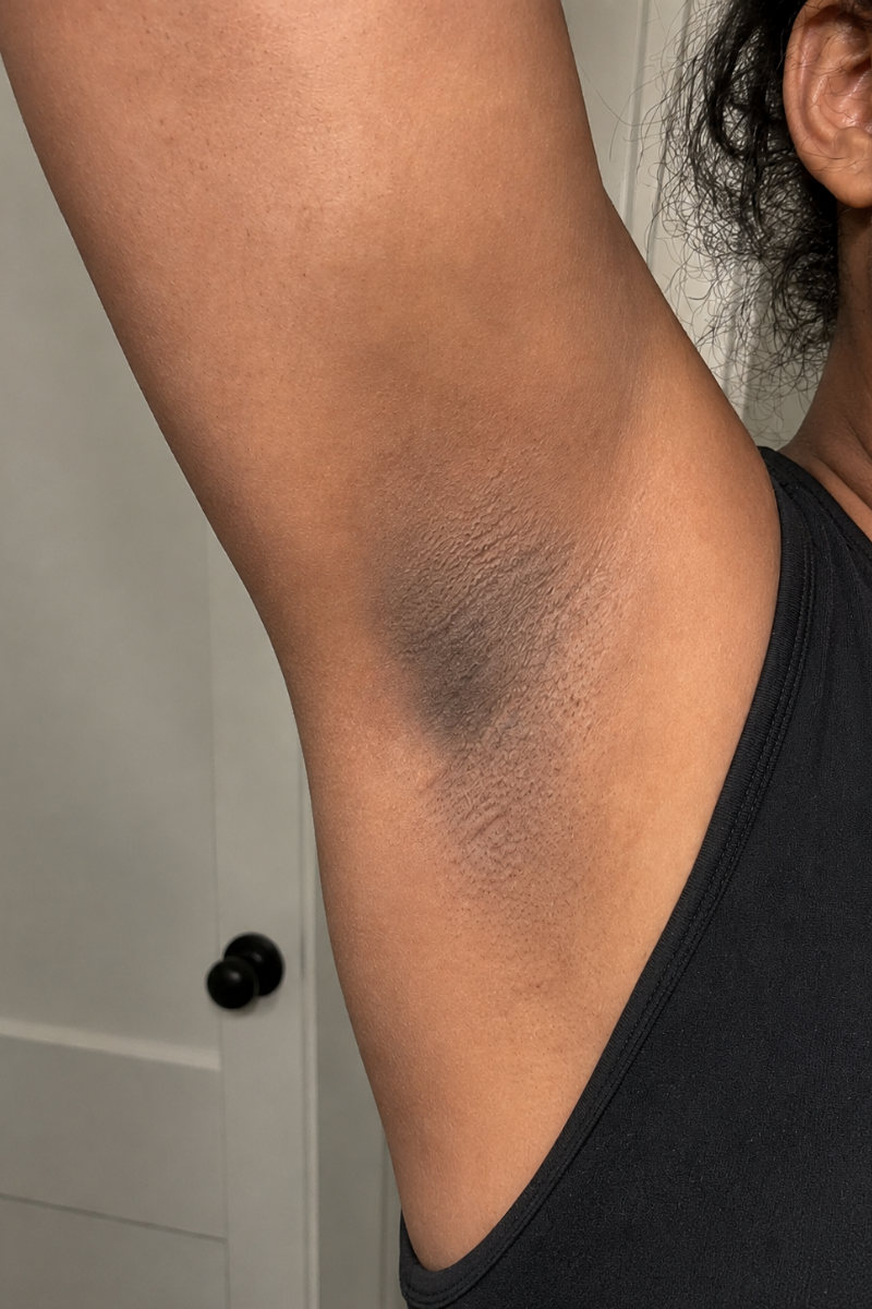 Underarms
